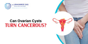 Can Ovarian Cysts Turn Cancerous