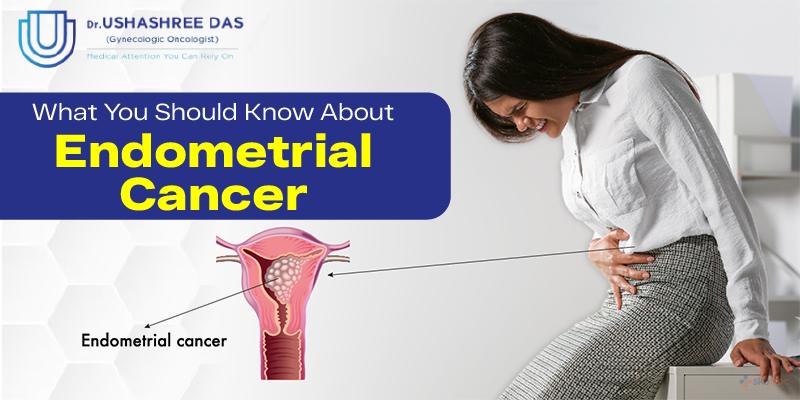 What You Should Know About Endometrial Cancer