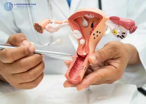 Why Gynecologic Cancer in Younger Women Is Found Late, and What Changes That