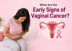 Home 27 What Are the Early Signs of Vaginal Cancer - Featured Image